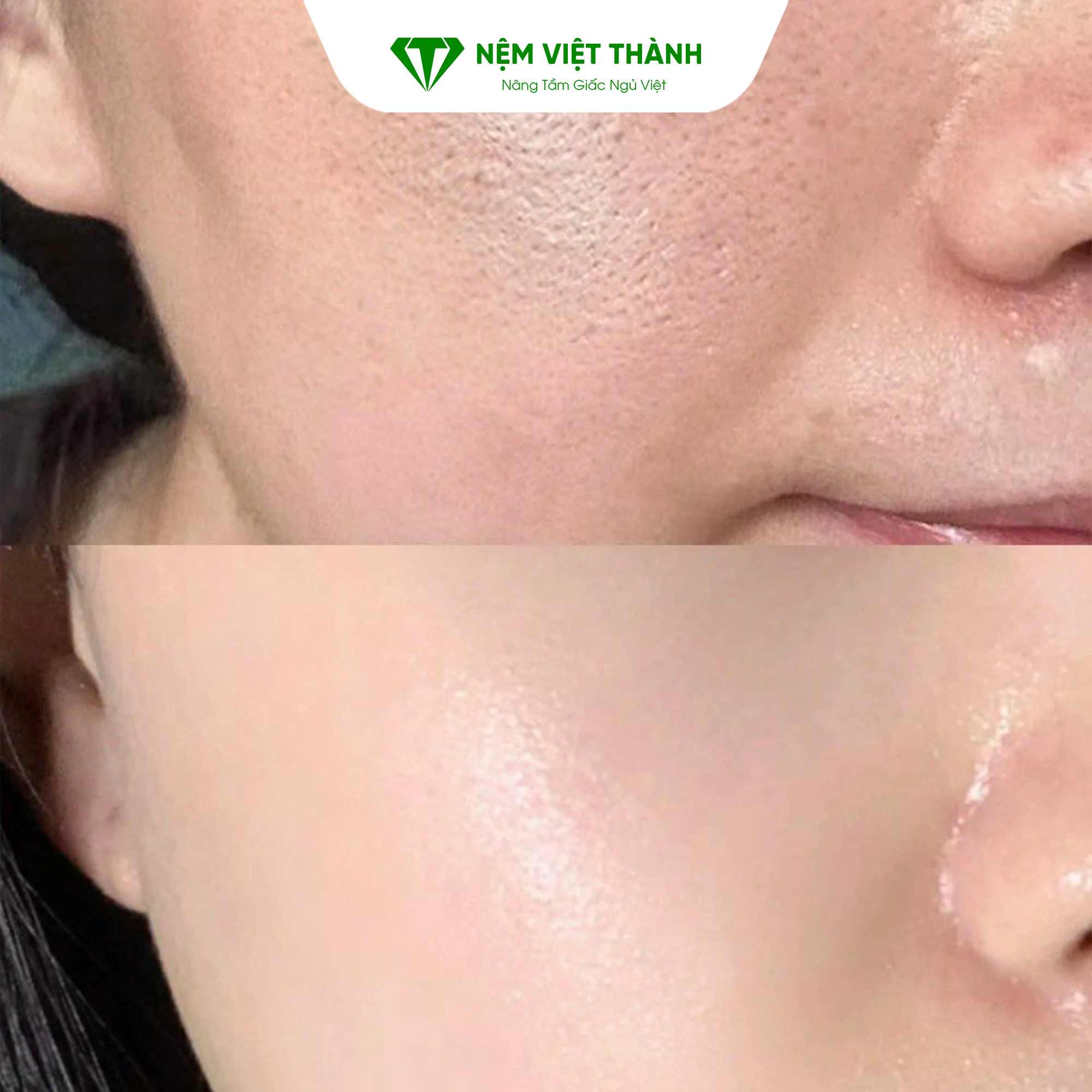 Se khít lỗ chân lông tự nhiên bằng phương pháp chườm đá lên mặt