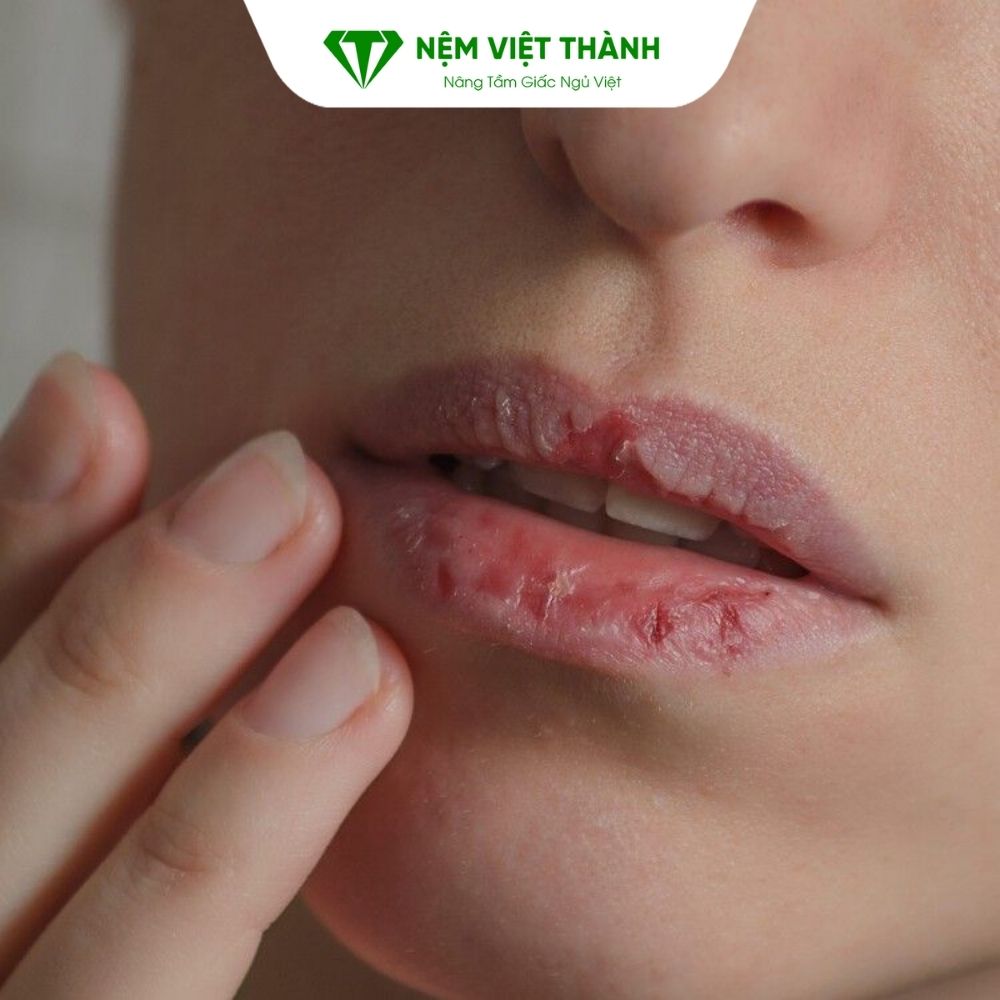 Khô miệng khi ngủ khiến vi khuẩn phát triển và gây đắng miệng buổi sáng