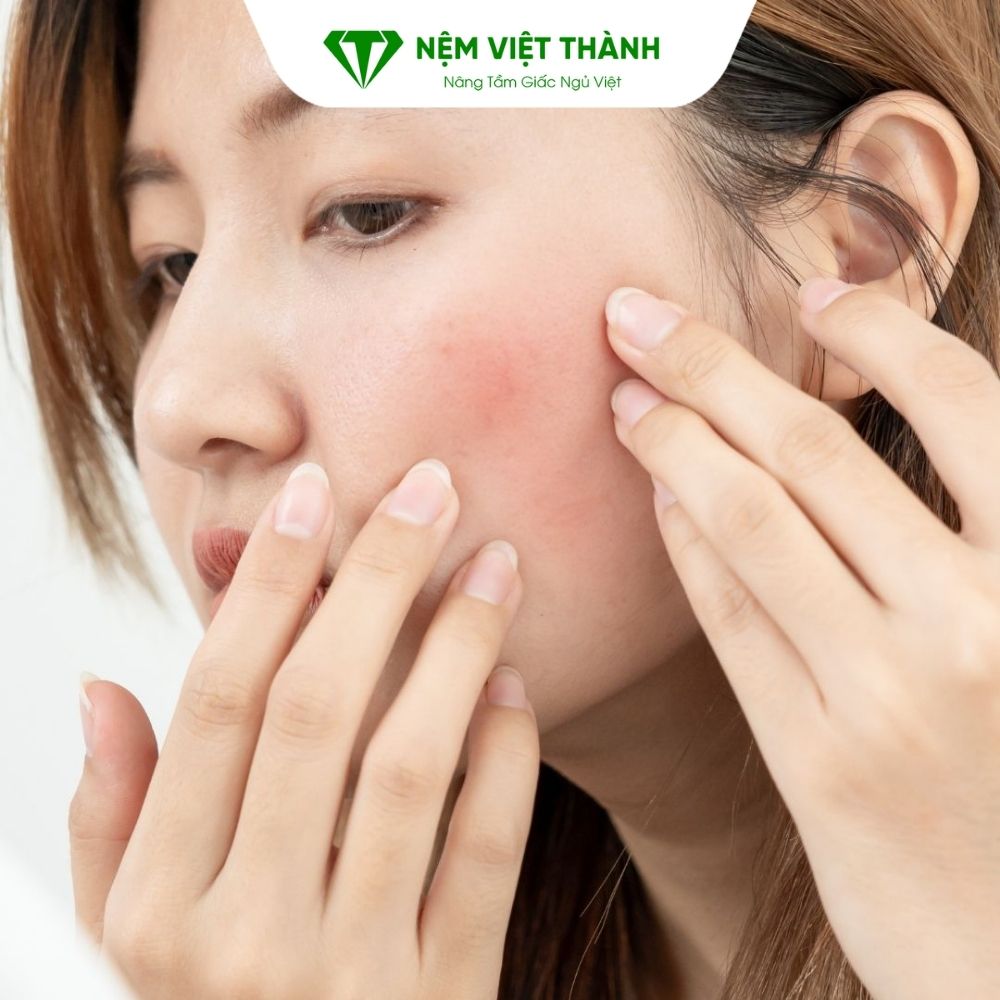 Nằm ngủ không gối giúp ngăn ngừa nếp nhăn và giảm mụn